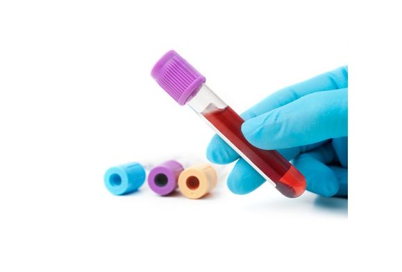 Bezpłatne testy anty-HCV