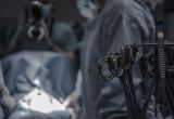 Rodzaje narzędzi chirurgicznych niezbędnych podczas operacji