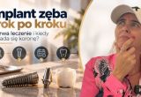 Implant zęba krok po kroku – ile trwa leczenie i kiedy zakłada się koronę?